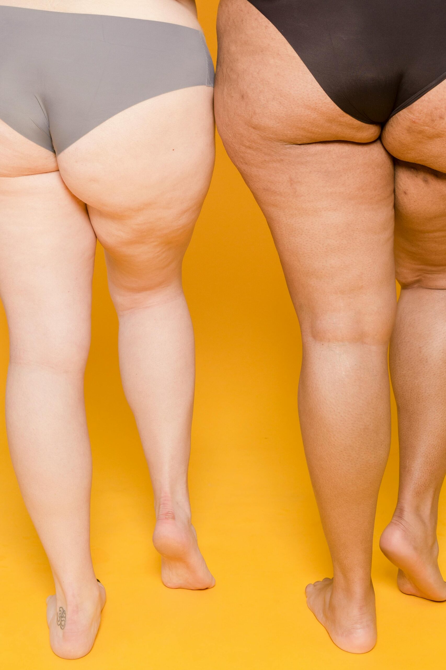 Mulher Lipedema, fundo amarelo 2 mulheres